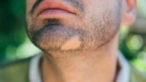 Comment combler un trou dans la barbe